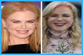 Nicole Kidman's "Lioness" Plastic Surgery: Uncovering Hidden Truths