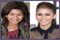 Unveiling The Secrets Of Zendaya's Nose Job: Discoveries And Insights